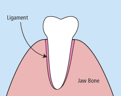 Teeth Extractions