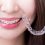 Orthodontic Options for a Beautiful Smile