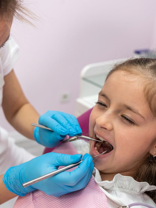 5 reasons to choose white fillings for kids’ teeth