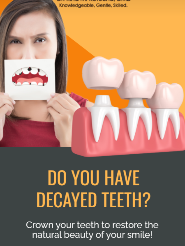 Do you have decayed teeth?
