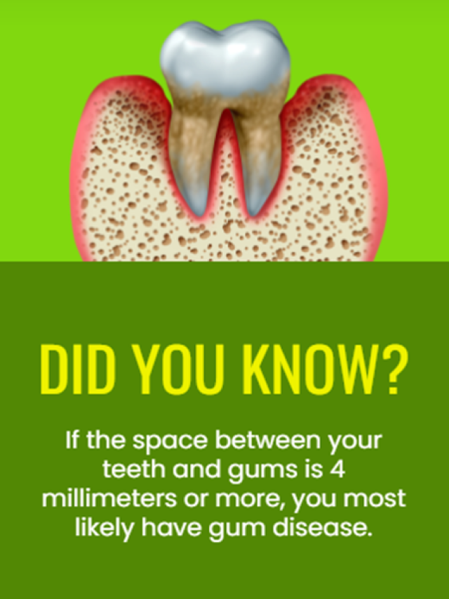 Did you know? If the space between your teeth and gums